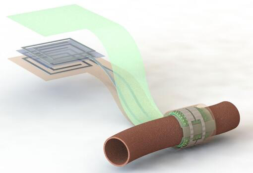 上圖描繪了這款可生物降解的壓力傳感器，它圍繞著一根血管，天線在左側(cè)(分離的層狀結(jié)構(gòu)，展示了天線結(jié)構(gòu)的細(xì)節(jié))
